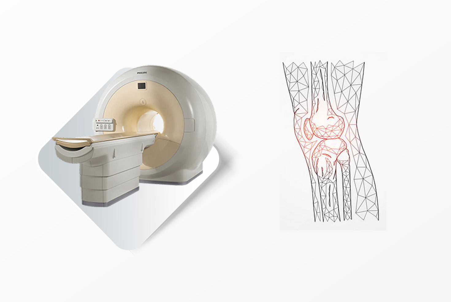magnetna rezonanca koleno