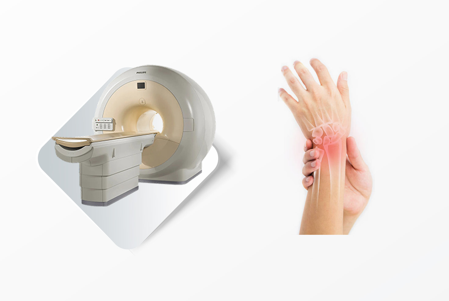 magnetna rezonanca rucnog zgloba
