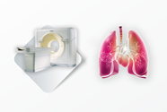 multislajsni skener pulmoangiografija pluca